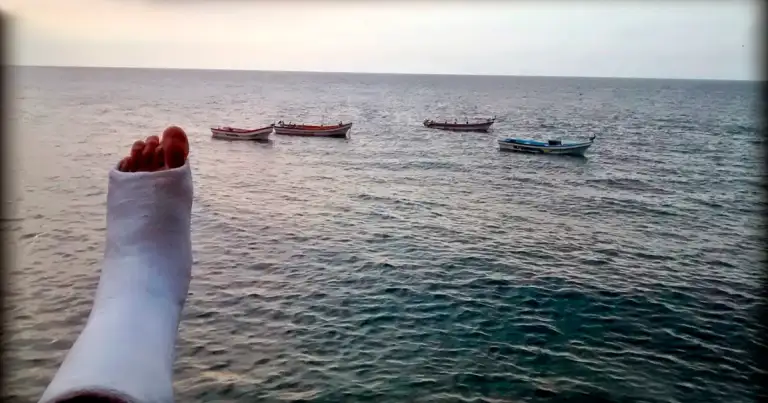 Persona con brazo en bota de escayola frente a embarcaciones en el mar